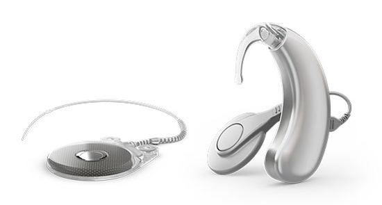 why cochlear implant in India why cochlear implant in India, cochlear implant india