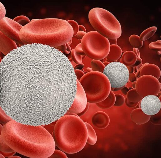 leukemia treatment in India, blood cancer treatment cost