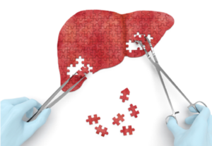 liver cancer surgery in india, best hospital for liver cancer treatment in india