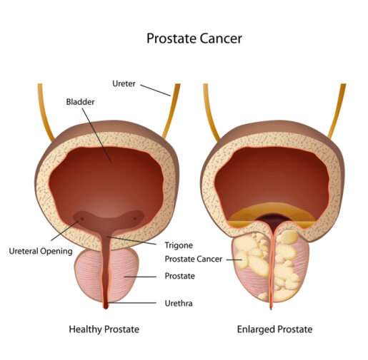 prostate and bladder medical vector illustration