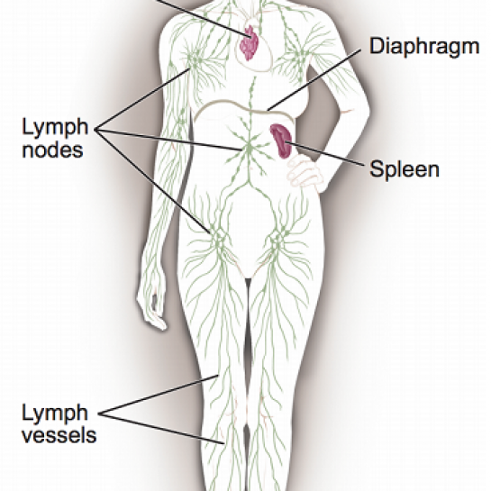 non hodgkin's lymphoma lymph nodes, non hodgkin's lymphoma treatment