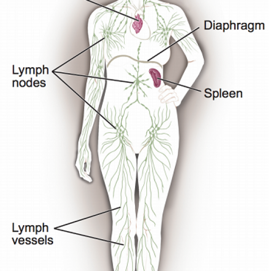 non hodgkin's lymphoma lymph nodes non hodgkin's lymphoma lymph nodes, non hodgkin's lymphoma treatment