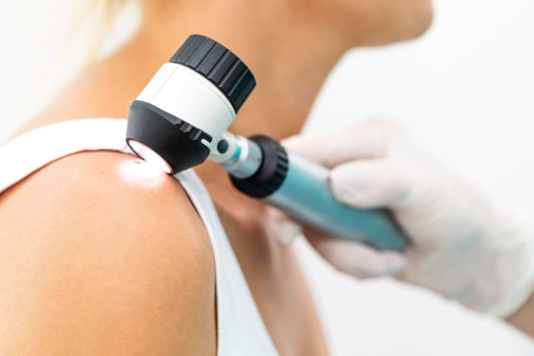 skin cancer treatment in india skin cancer treatment in india, skin cancer treatment cost in india, treatment for skin cancer