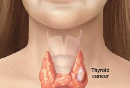 best thyroid treatment in india, thyroid surgery cost in india