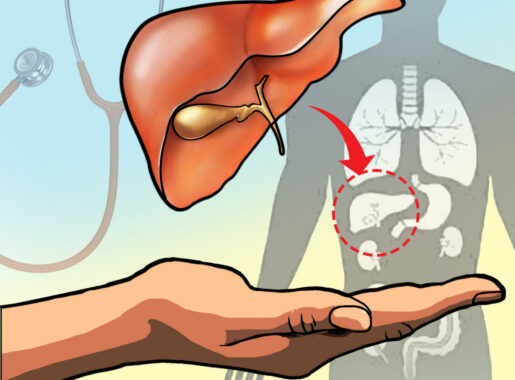 what is liver transplant, liver transplant in india