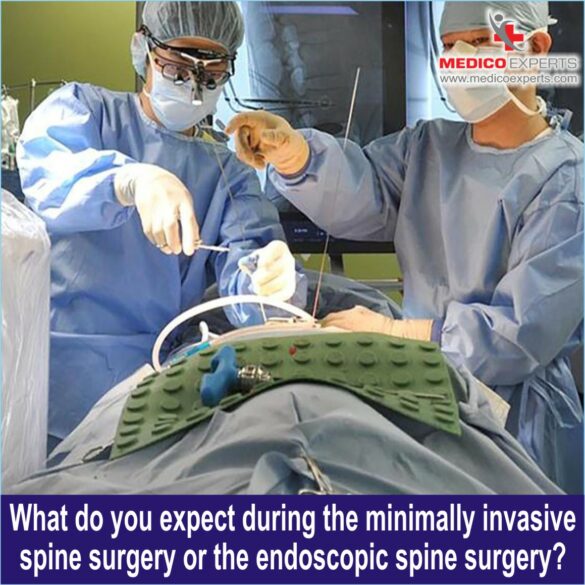 Expect during surgical spine surgery, endoscopic spine surgery