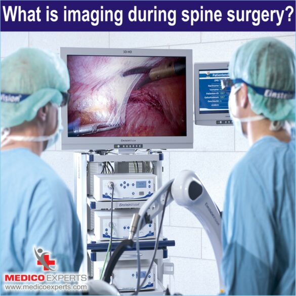 Imaging during spine surgery, endoscopic spine surgery