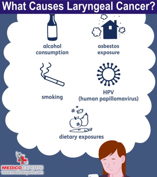 What causes laryngeal cancer, laryngeal cancer survival rate