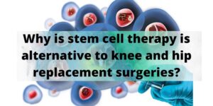stem cell therapy for osteoarthritis,
stem cell therapy for joints,  stem cell therapy is alternative to knee and hip replacement surgeries
