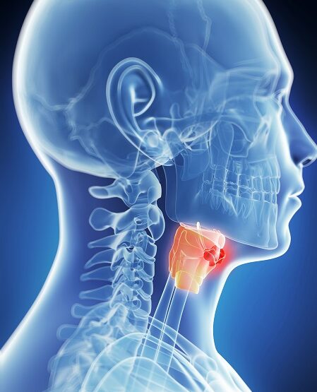 larynx_cancer-treatment in india larynx_cancer-treatment in india, laryngeal cancer treatment in india