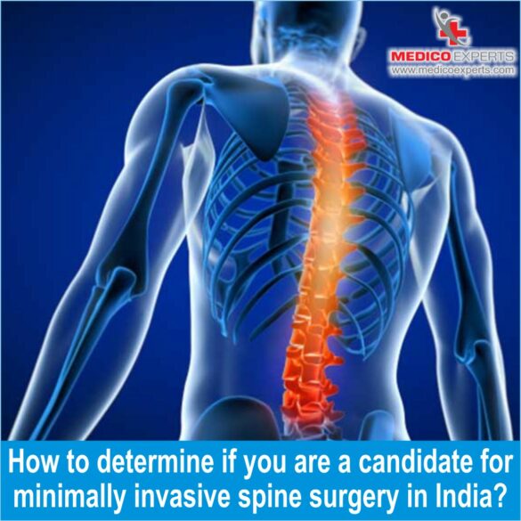 minimally invasive spine surgery minimally invasive spine surgery, minimally invasive spine surgery types