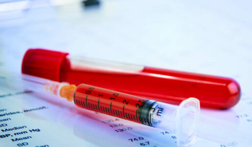 How is sickle cell disease diagnosed sickle cell anemia diagnosis tests