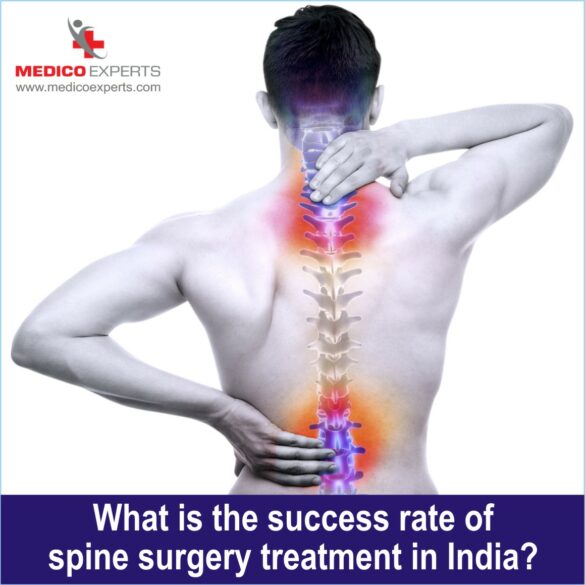 success rate spine surgery, endoscopic spine surgery