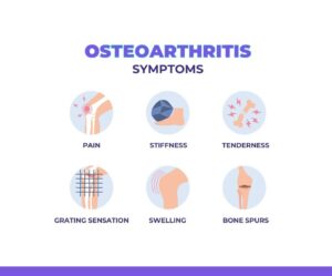 symptoms of osteoarthritis, how to avoid knee replacement surgery, knee replacement surgery alternatives

