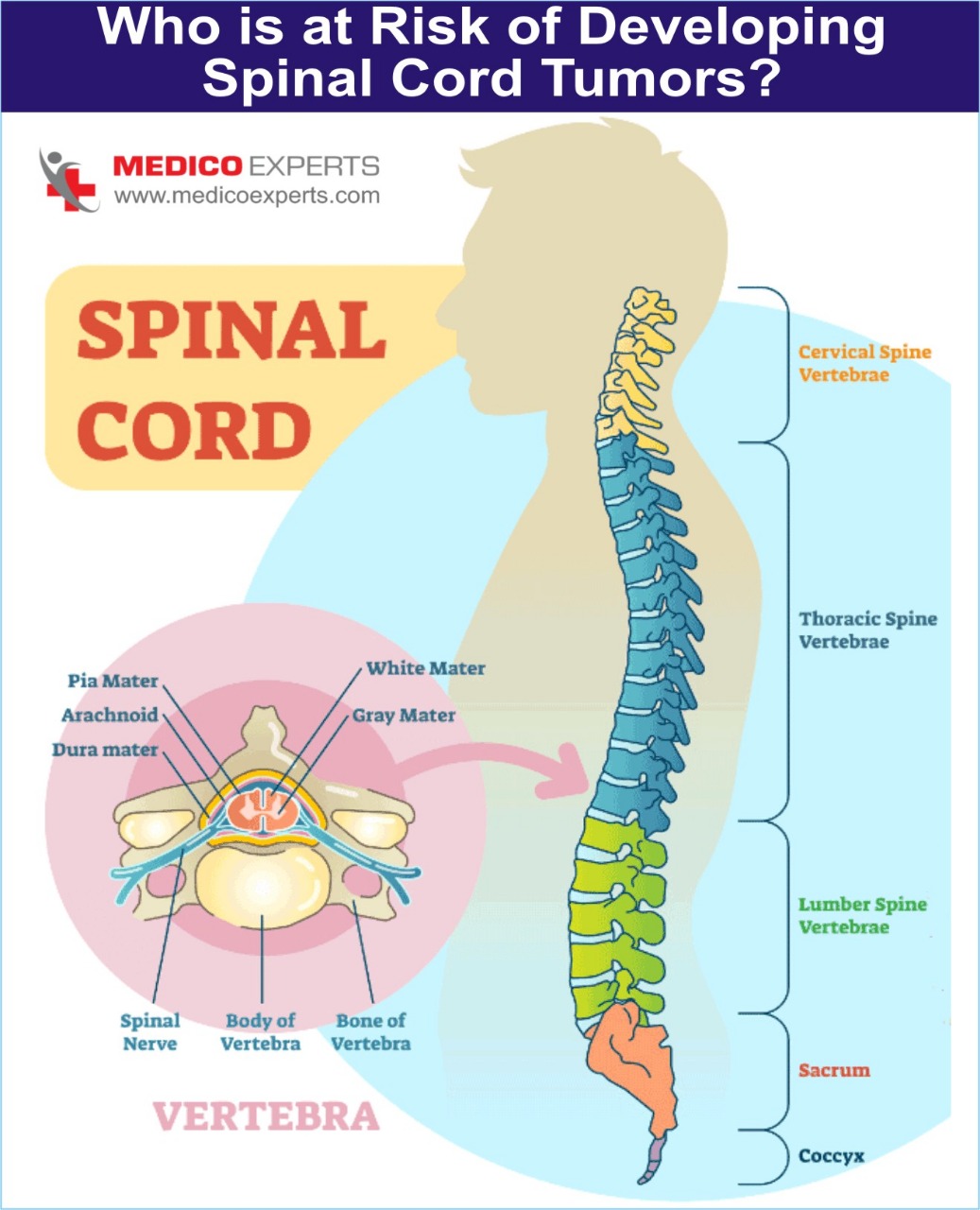 who at the risk of spinal cord tumor