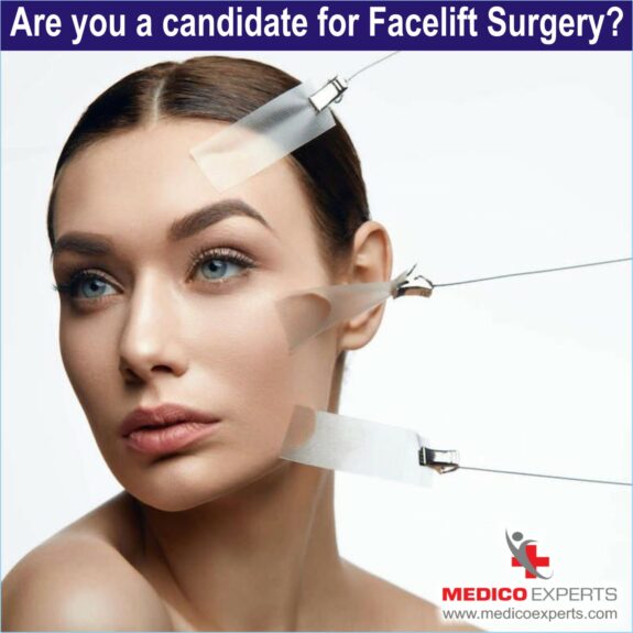 Are you a candidate for Facelift Surgery, facelift surgery before and after