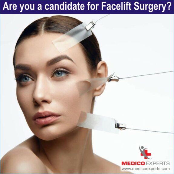 Are you a candidate for Facelift Surgery Are you a candidate for Facelift Surgery, facelift surgery before and after