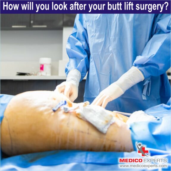 How will you look after your butt lift surgery