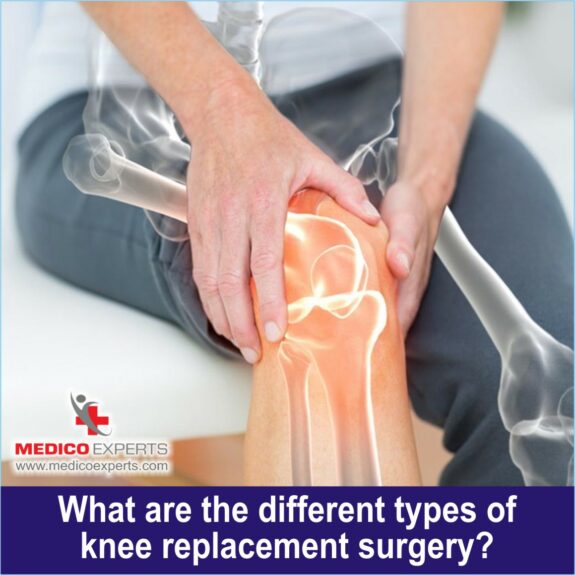 What are the different types of knee replacement surgery, best hospital for knee replacement surgery in india