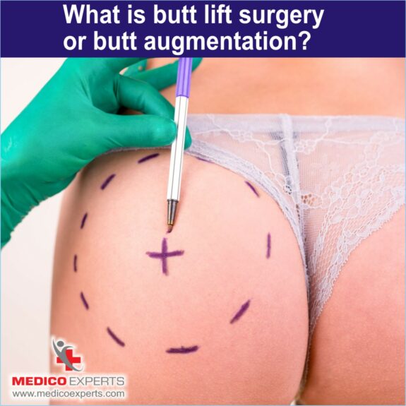 What is butt lift surgery