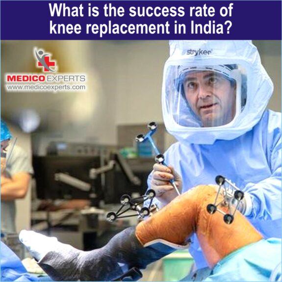 What is the success rate of knee replacement in India1 Success rate of knee replacement in India, knee replacement success rate in india, knee replacement surgery cost