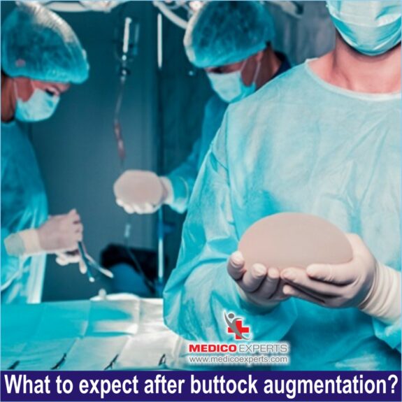What to expect after buttock augmentation