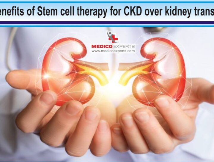 10 Benefits of Stem cell therapy for chronic kidney disease over kidney transplant