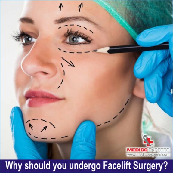 Why should you undergo facelift surgery, facelift surgery in india