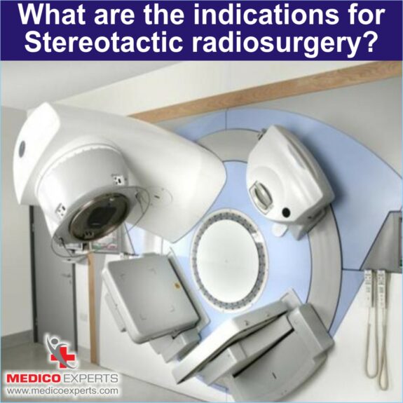 indications for Stereotactic radiosurgery