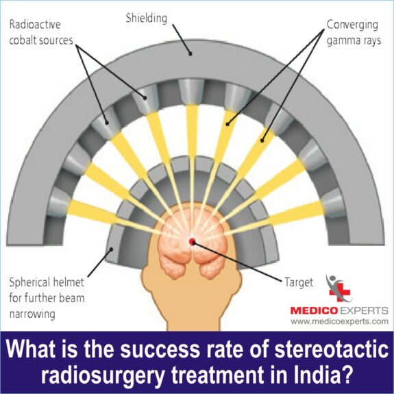 success rate of stereotactic radiosurgery