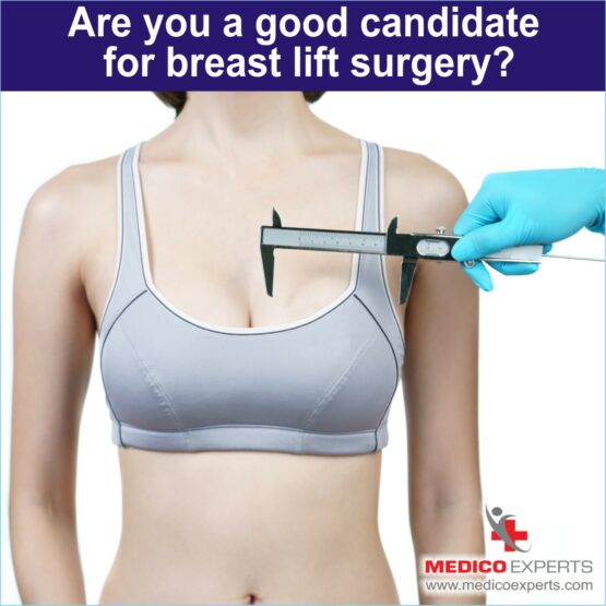 Are you a good candidate for breast lift surgery