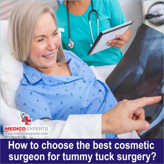 How to choose the best cosmetic surgeon for tummy tuck surgery
