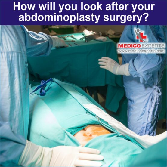 How will you look after your abdominoplasty surgery