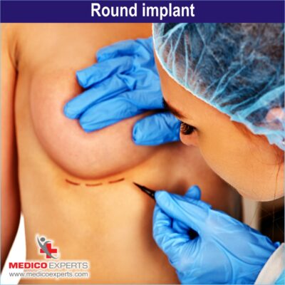 Round implant