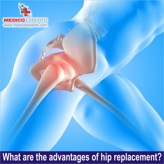 What are the advantages of hip replacement, cost of hip replacement surgery in india
