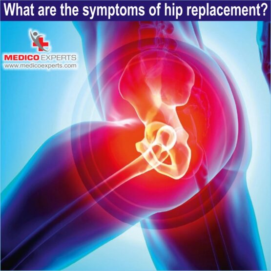 What are the symptoms of hip replacement
