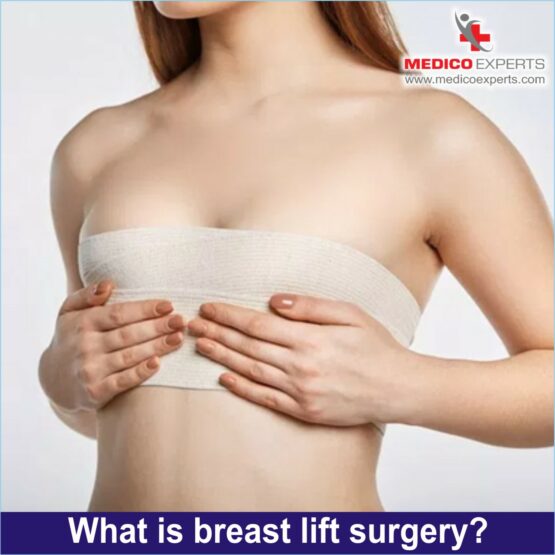 What is breast lift surgery