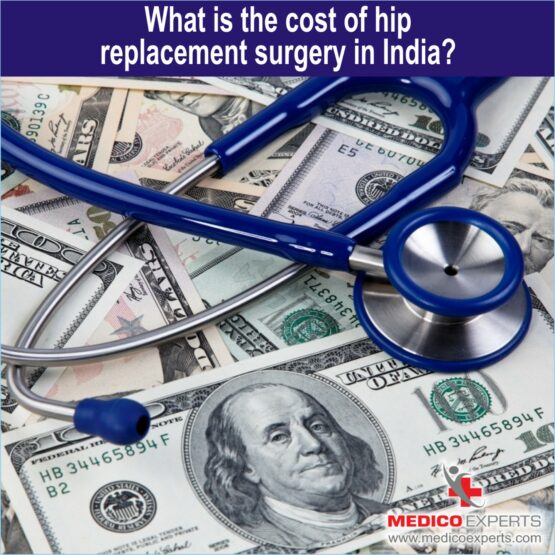 hip replacement surgery cost in india, cost of hip replacement surgery in india