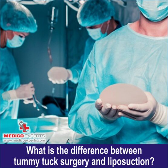 What is the difference between tummy tuck surgery and liposuction
