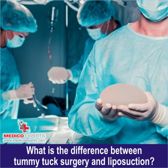 What is the difference between tummy tuck surgery and liposuction What is the difference between tummy tuck surgery and liposuction