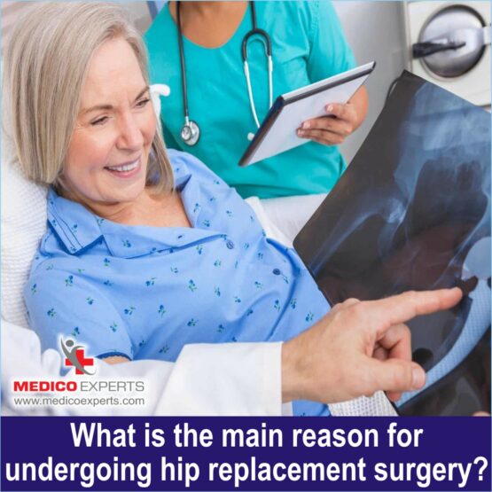 What is the main reason for undergoing hip replacement surgery, best hip replacement surgeon in india