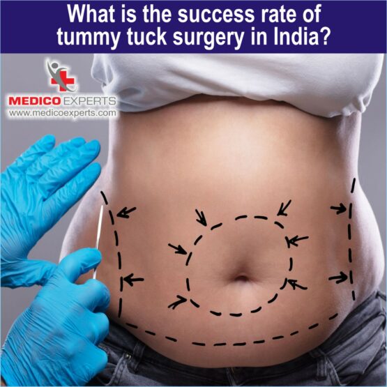 tummy tuck surgery in India