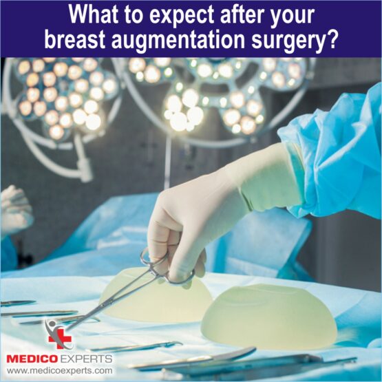 What to expect after your breast augmentation surgery