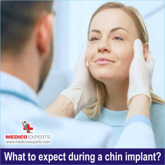 What to expect during a chin implant