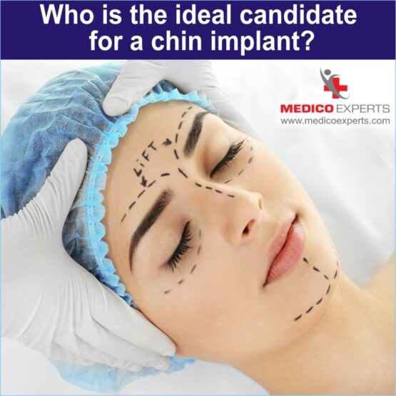 Who is the ideal candidate for a chin implant
