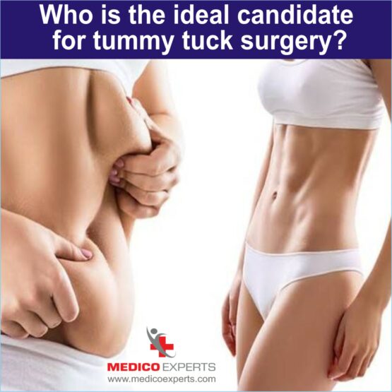 Who is the ideal candidate for tummy tuck surgery