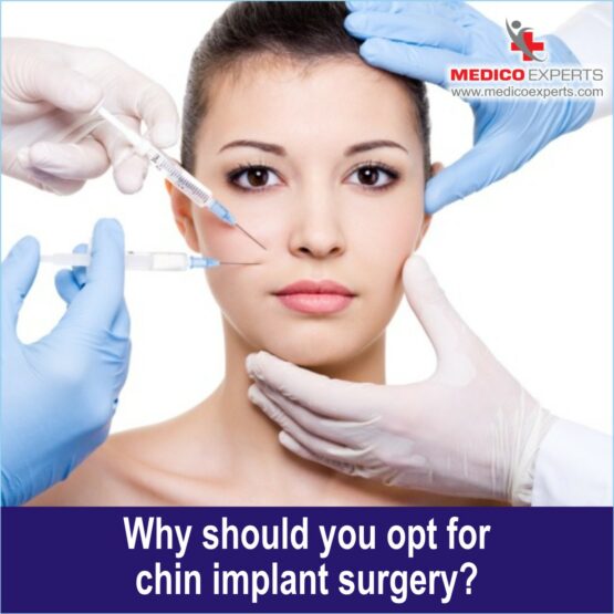 Why should you opt for chin implant surgery