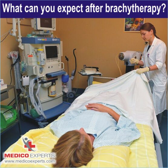 advantages of brachytherapy