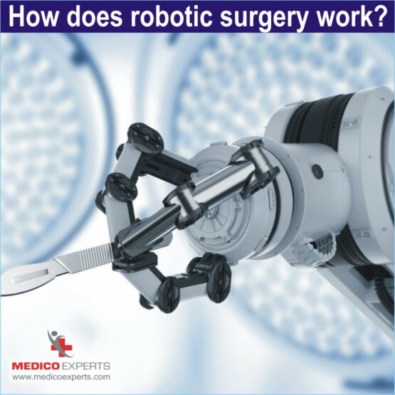 advantages of robotic surgery