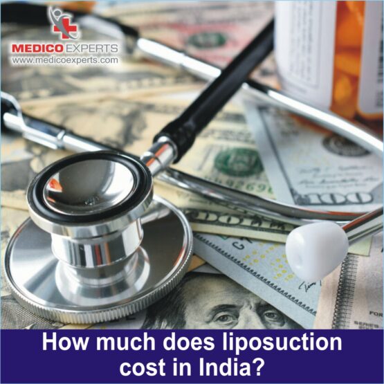 liposuction cost in India